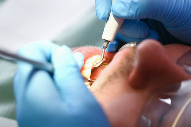 Professional Emergency Dentist in MA
