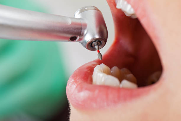 Best Emergency Dental Services for Seniors in Revere, MA